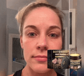 BOTOXMIX Bee Venom Anti-Rid